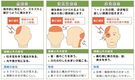 頭痛 原因|頭痛・顔面痛の種類と原因｜受診科と自分でできる対処法も紹介 